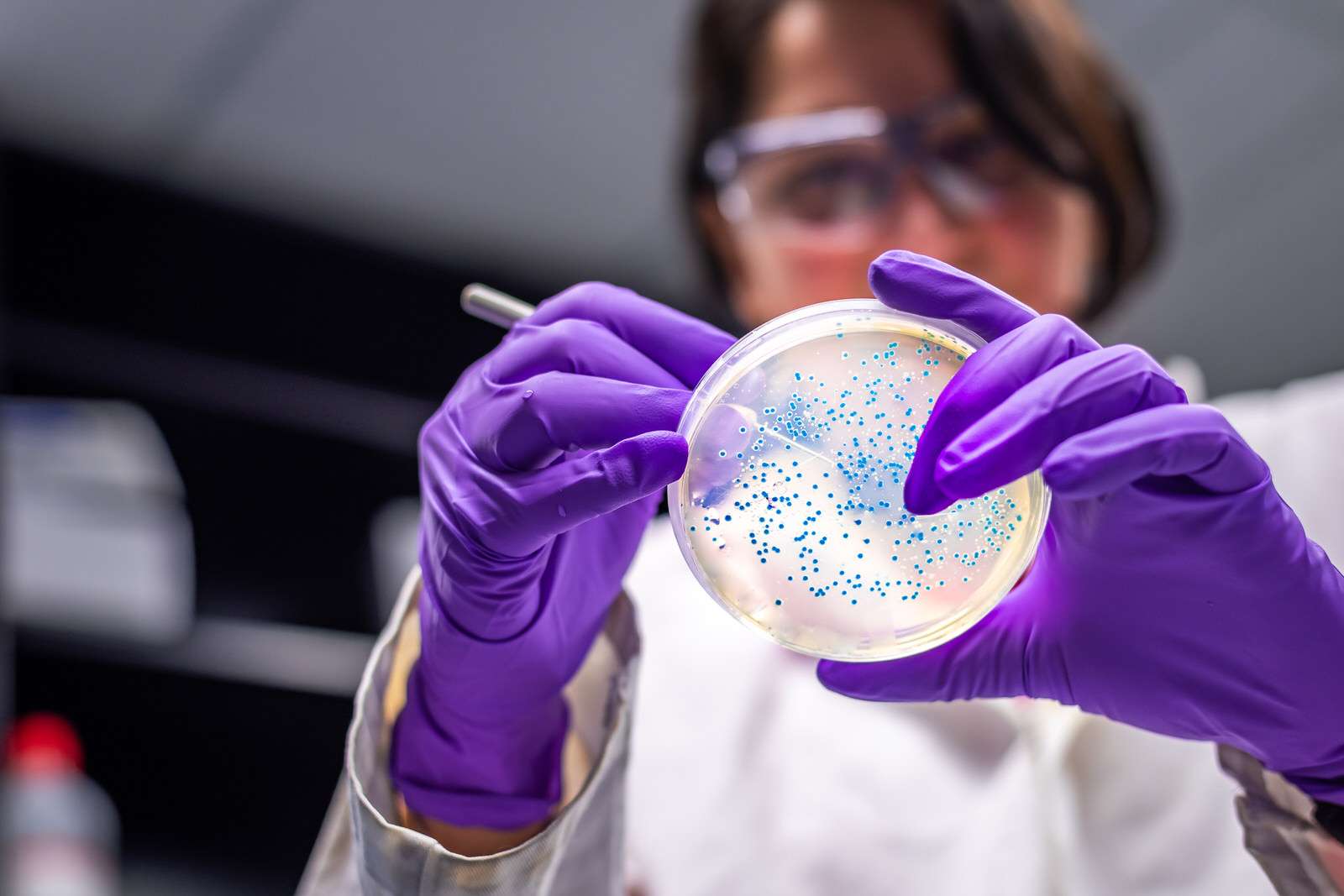 e-coli-infeccion-orina-urocran-cistitis-tratamiento