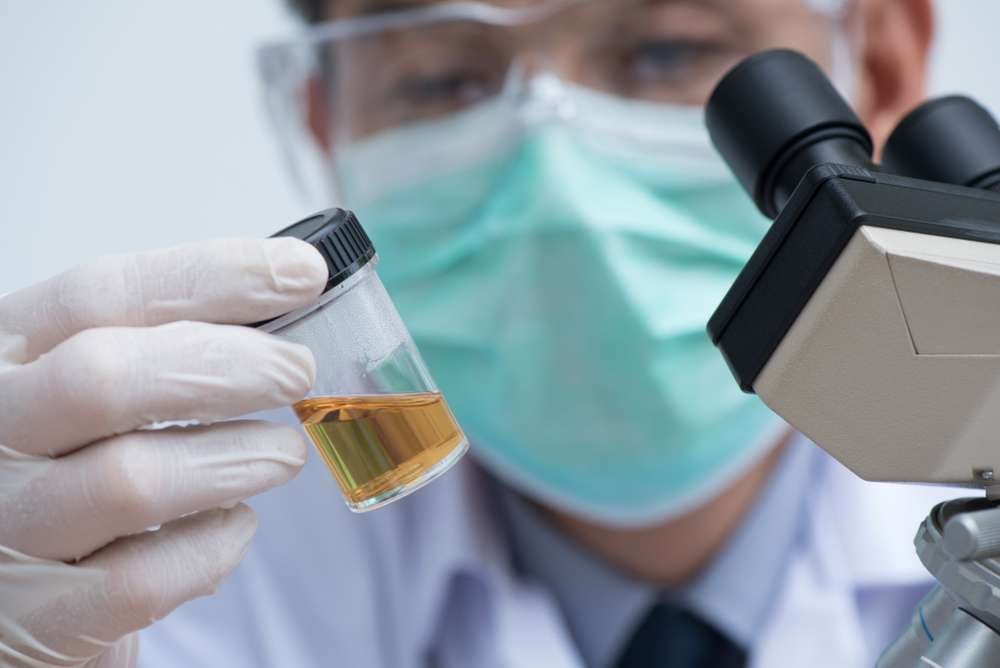 Detalle de laboratorio analizando una muestra de orina