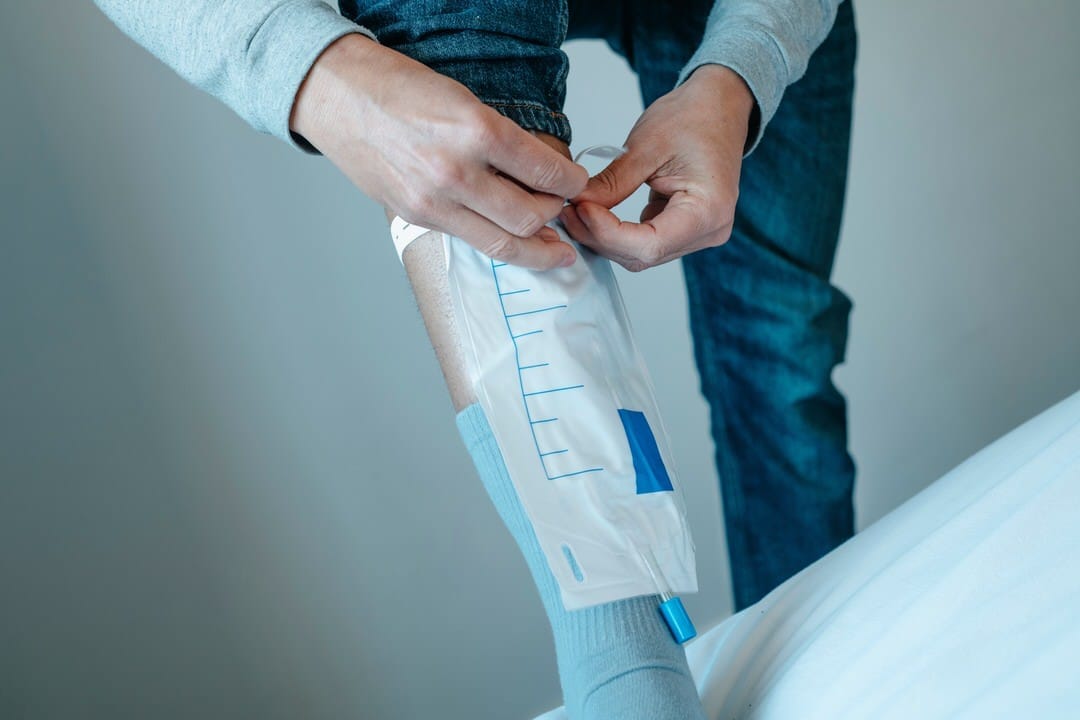  sonda-vesical-urinario-hombre-urocran-forte-Proteus-mirabilis