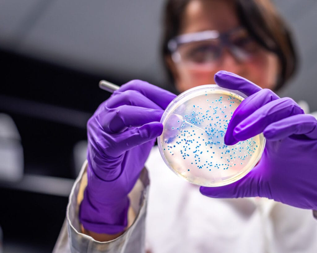 woman researcher performing examination of bacterial culture plate