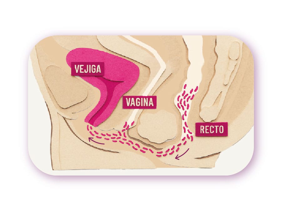 Ilustración