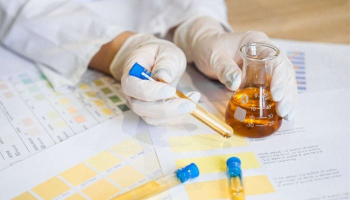 color de orina en análisis